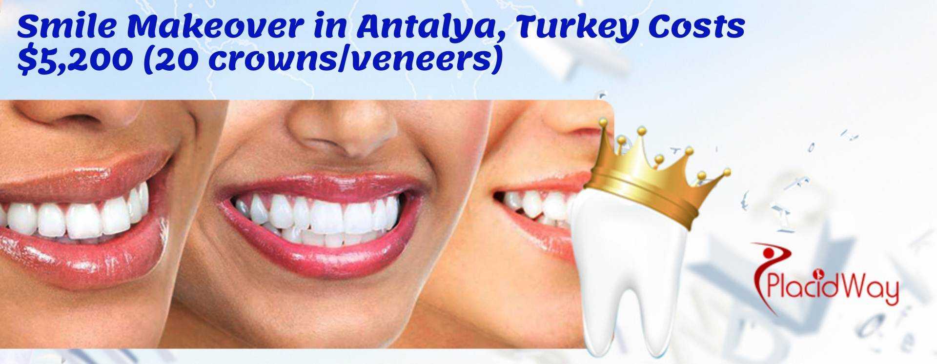 Smile Makeover in Antalya, Turkey